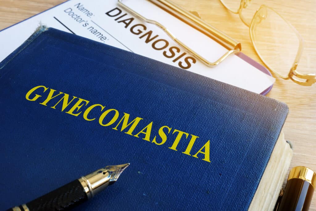what is gynecomastia in gynecomastia 5f32dc68cd745