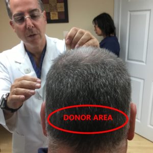 DONOR AREA