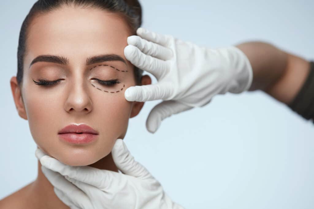 Eyelid surgery